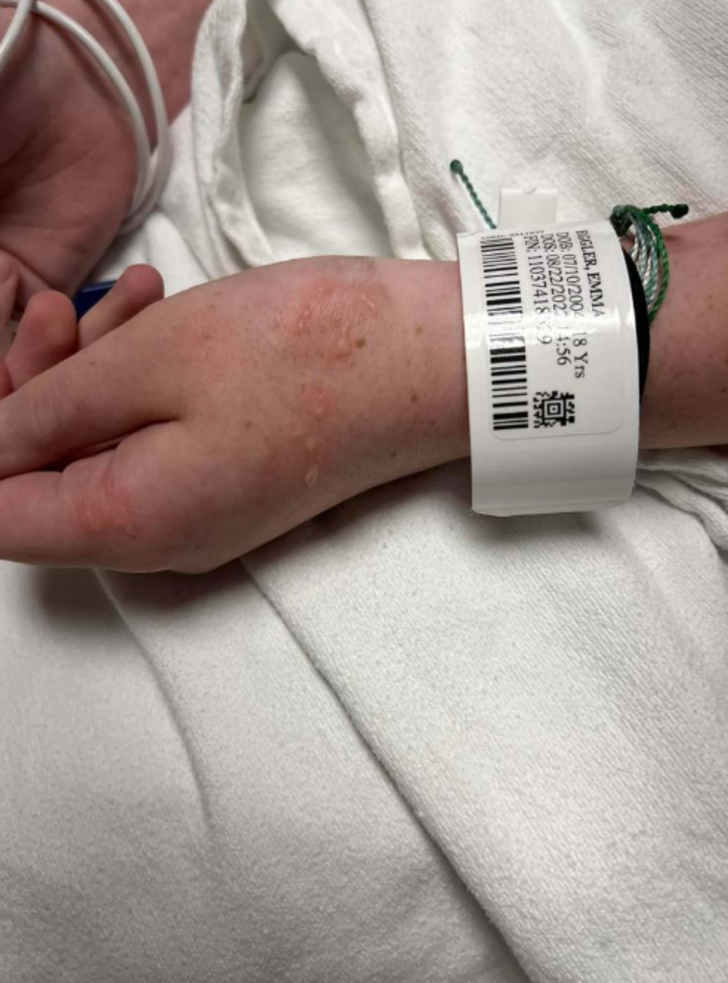 Mucize kurtuluş! Okulun ilk gününde göğsüne yıldırım düştü, neye uğradığını şaşırdı G5