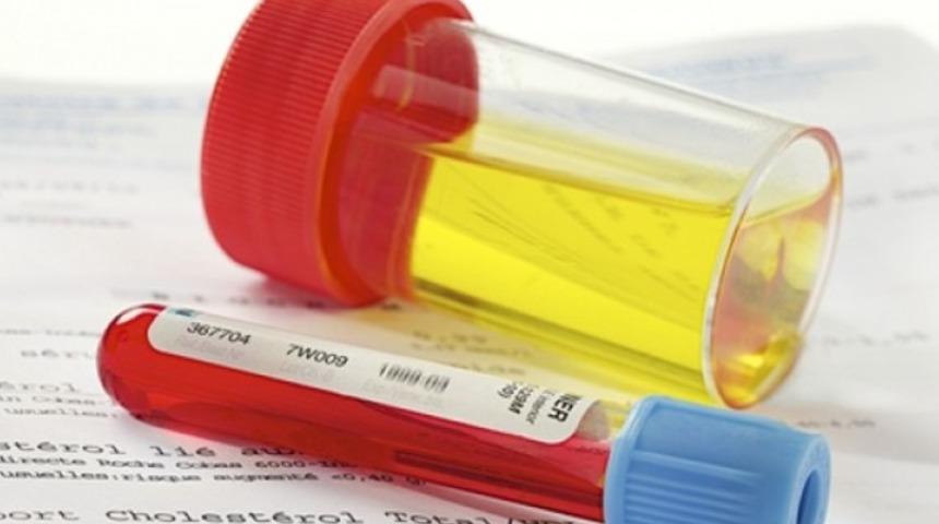 İdrardan kan gelmesinin sebebi nedir?