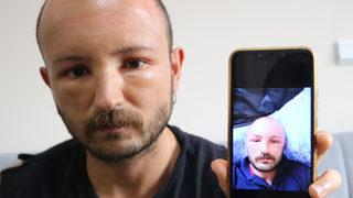 Tatil için gittiği Zonguldak'ta denize girdi! Başı şişmeye başladı...