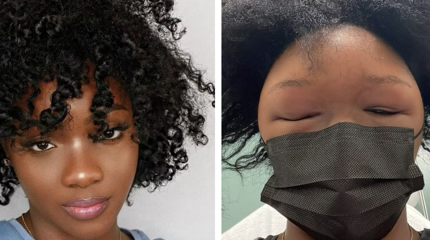 Neredeyse kör oluyordu! Saç boyası yüzünden başına gelenler dehşete düşürdü