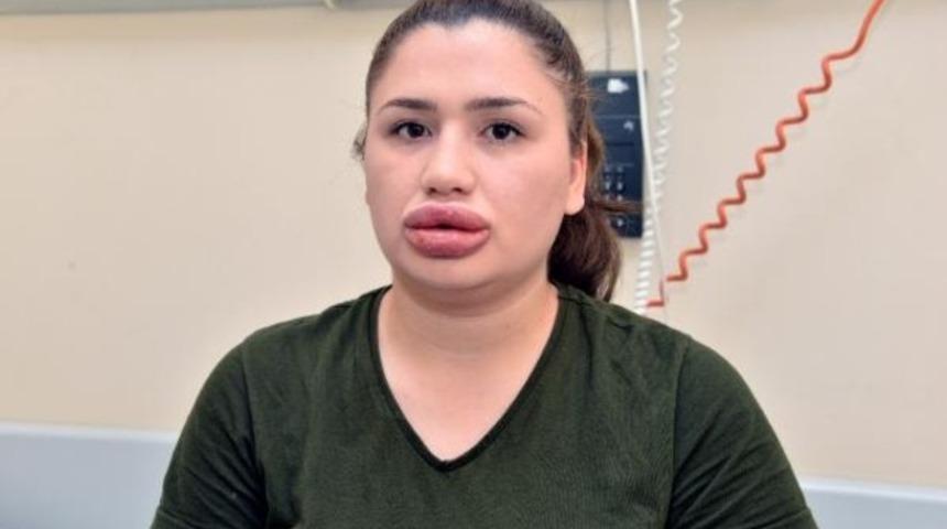 Silikon kurbanı Merve hemşire i&ccedil;in doktorlardan ilk a&ccedil;ıklama