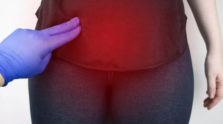 Her kadında görülebilir! Gaz şişkinliği sandı ama 15 kilogramlık kist çıktı