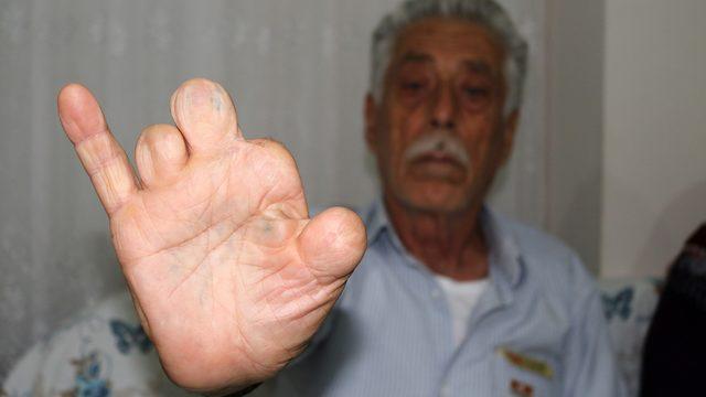 Yer: Antalya! Kıbrıs gazisine korkunç dayak... 'Ben bu ülke için canımı feda ettim'