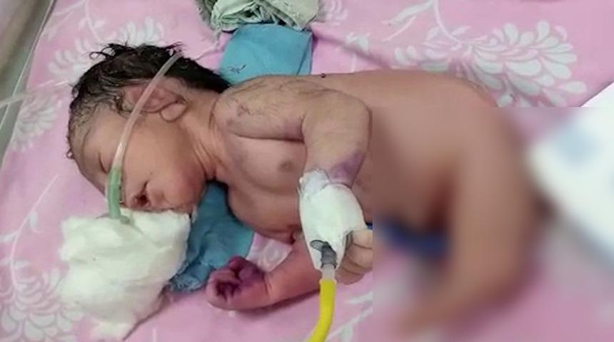 Bacakları yerine garip boynuzu var! Yeni doğan bebeği görenler küçük dilini yuttu