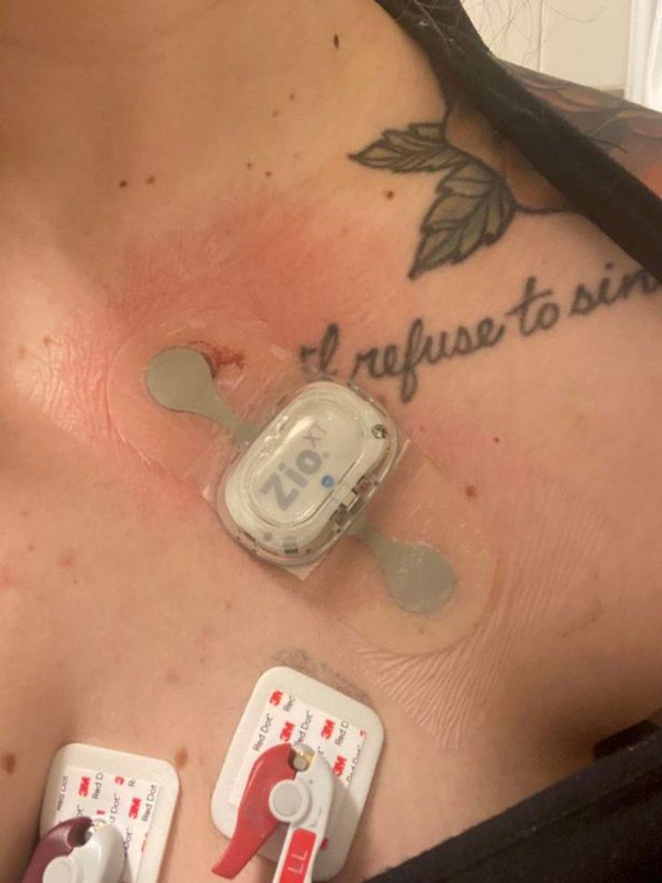 Sadece 10 dakika ayakta durabiliyor! Hastalığı doktorları şoke etti: Yerçekimine alerjim var G3