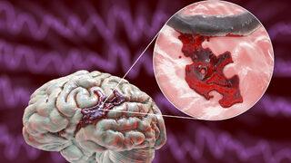 Sebebi bilinmiyor: Hemen kontrol edin! Tehlike beş kat daha fazla