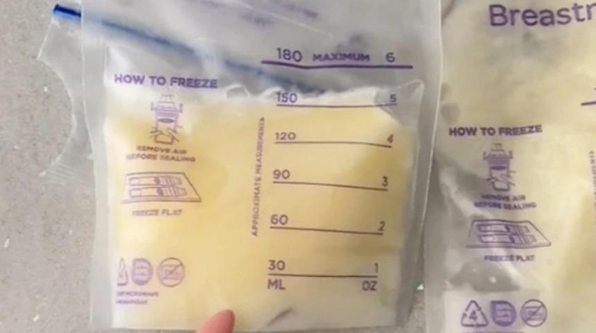 Oldukça şaşırtıcı: Anne sütünün turuncuya dönme nedenini paylaştı! Anne sütünün rengi neden değişir?