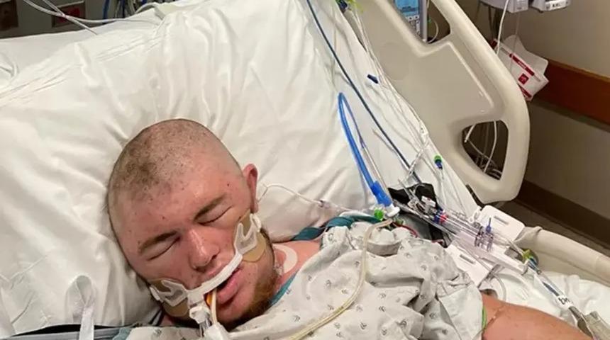 Yanlışlıkla kovanı kesince olanlar oldu! 20.000 kez sokulan adam 30 arıyı da yutunca...