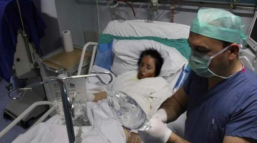 Boşanmak isteyen eşinin üzerine kaynar su döktü