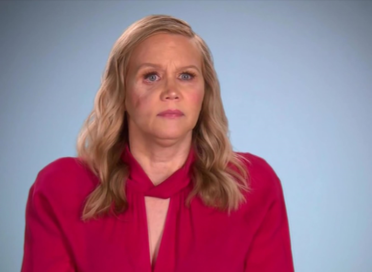 Son haline inanamayacaksınız! Güzelleşmek için dolgu yaptırmak istedi, yüzü delindi G4