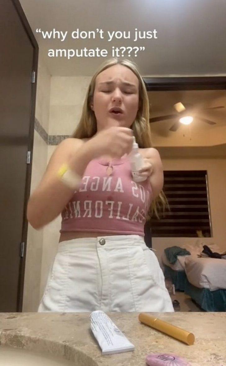 Tek kolu ve iki eli olan TikTok fenomeni eleştirilerin hedefi oldu! “Onu kesmelisin” G5