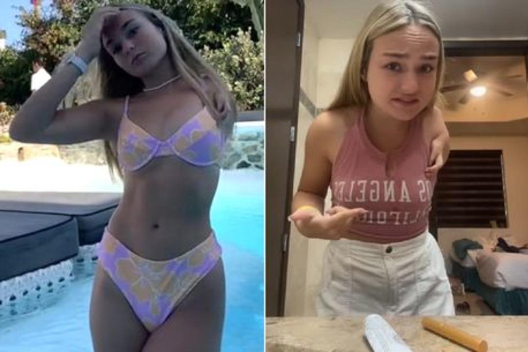 Tek kolu ve iki eli olan TikTok fenomeni eleştirilerin hedefi oldu! &ldquo;Onu kesmelisin&rdquo;