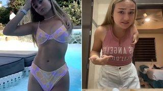 Tek kolu ve iki eli olan TikTok fenomeni eleştirilerin hedefi oldu! “Onu kesmelisin”