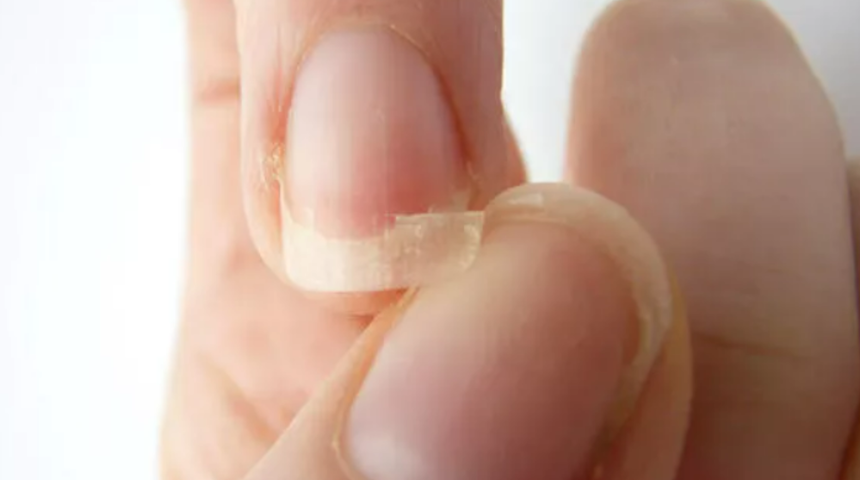 Tırnak kırılmalarından şikayetçiyseniz bu yöntemleri deneyin! Tırnaklarınızı güçlendirecek etkili yöntemler