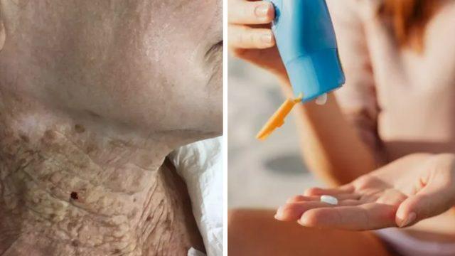 Güneş koruyucunun etkileri şaşırttı! Neden düzenli olarak güneş kremi sürmeliyim diyorsanız…
