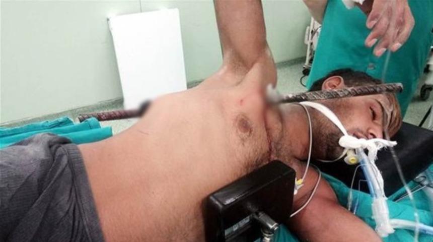 Demir &ccedil;ubuk g&ouml;ğs&uuml;nden girip sırtından &ccedil;ıktı