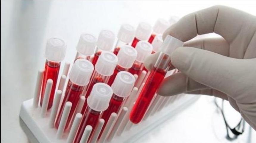 Basit bir kan testi ile yumurtalık rezervine mutlaka baktırın