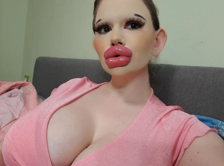 Dünyanın en büyük dudaklarına sahip olduğunu iddia eden kadın yine durmadı! Yeni ameliyatı için rotayı Türkiye’ye çevirdi G1