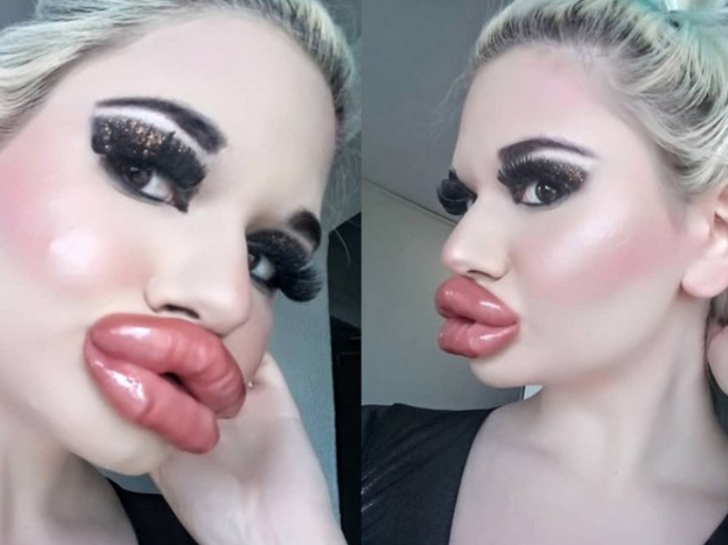 Dünyanın en büyük dudaklarına sahip olduğunu iddia eden kadın yine durmadı! Yeni ameliyatı için rotayı Türkiye’ye çevirdi G5