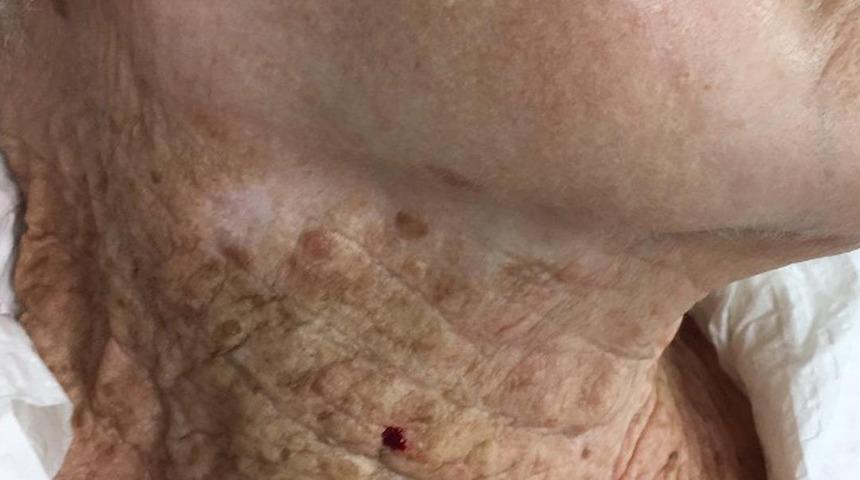 Aradaki fark dudak uçuklattı! Doktorlar 'sakın unutmayın' diyerek bu kareyi paylaştı