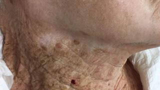 Aradaki fark dudak uçuklattı! Doktorlar 'sakın unutmayın' diyerek bu kareyi paylaştı