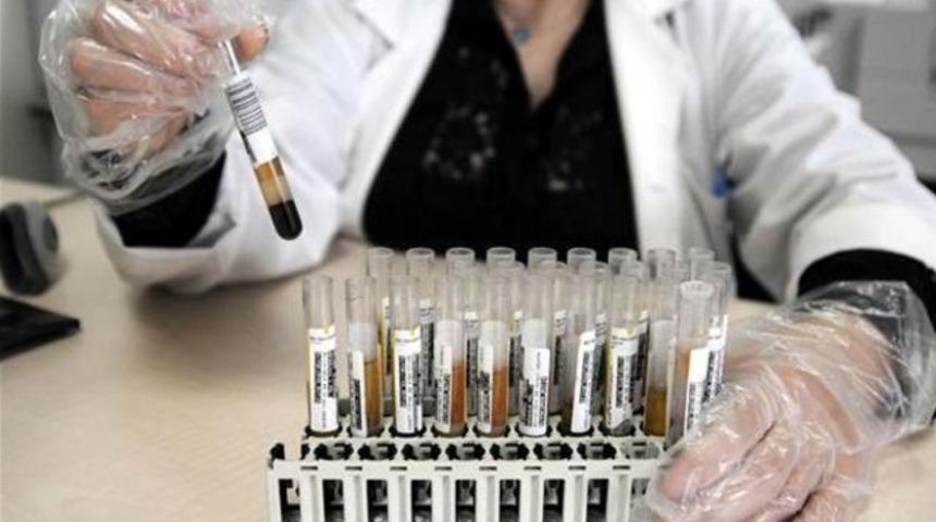 Beyin- sinir hastalıkları  ve amino asid tedavisi