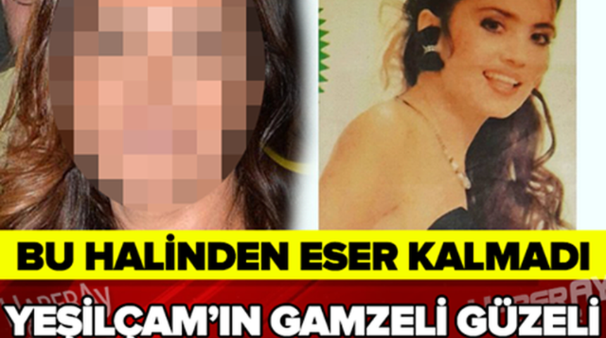 Kanser Tedavisi G&ouml;ren Yeşil&ccedil;am G&uuml;zeli Bakın Şimdi Ne Halde Şok Olucaksınız