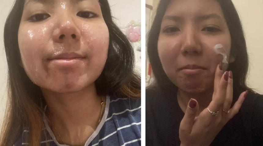 TikTok zıvanadan çıktı! Şimdi de slugging akımı: Yüzlerine sürüp paylaşıyorlar