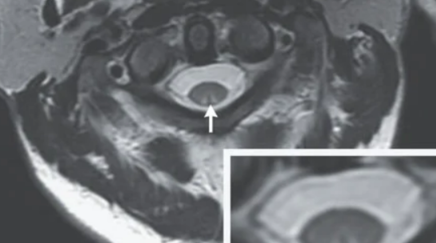 Sadece gülmek istemişti! Gülme gazı nedeniyle yürüyememeye başladı