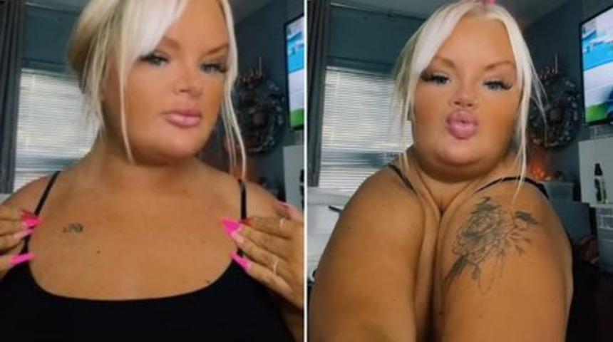 Köprücük kemikleri olmadan doğdu! “Vücudumu ikiye katlayabiliyorum”