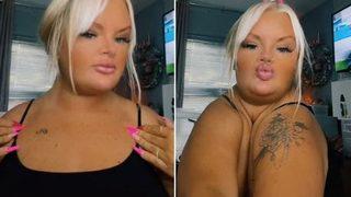 Köprücük kemikleri olmadan doğdu! “Vücudumu ikiye katlayabiliyorum”