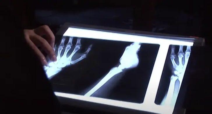 İngiliz bilim insanlarının araştırmasına konu olan Türk aile! Görenler şaşkına dönüyor G4