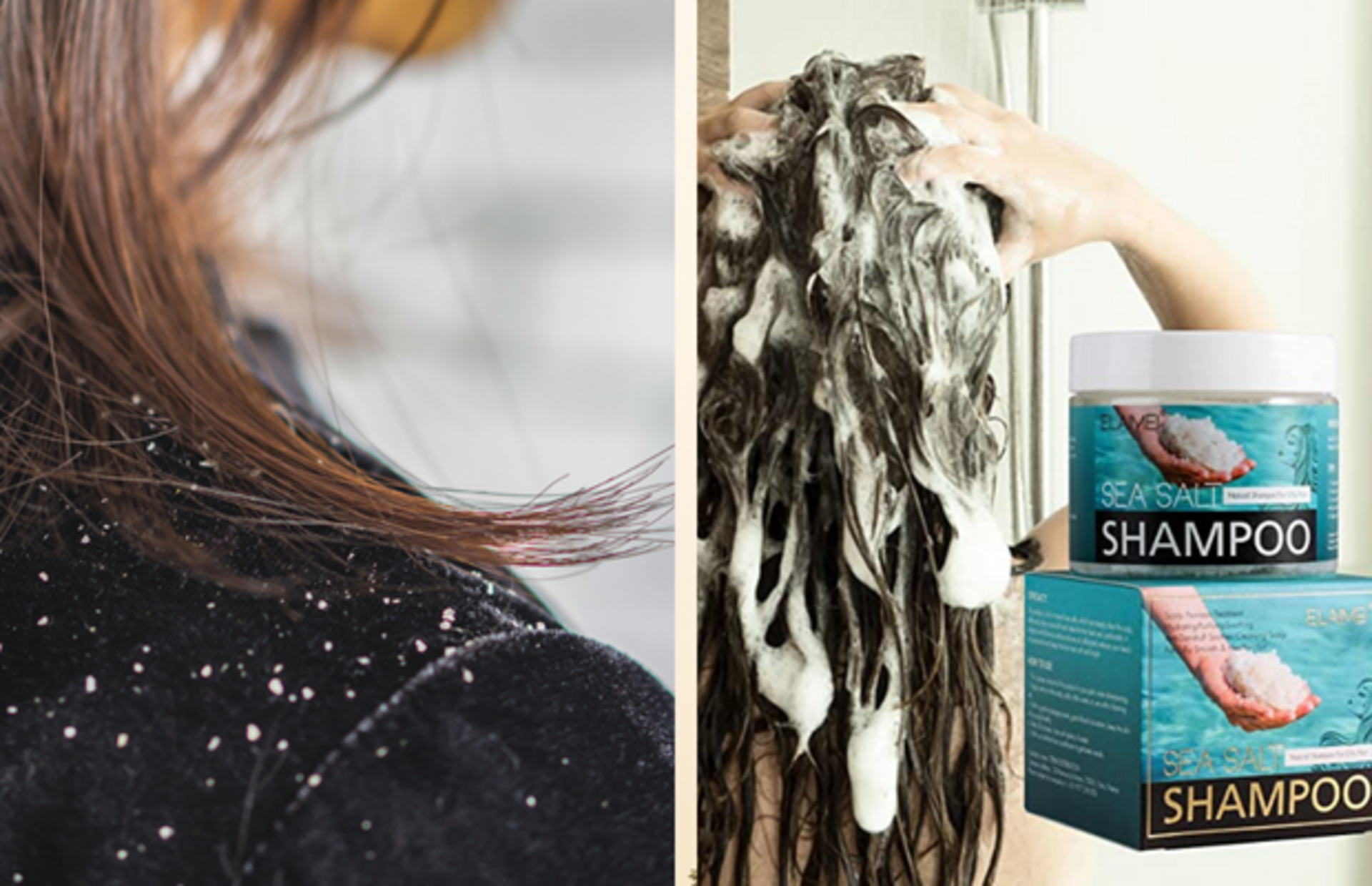 Kepek sorunu yaşayanların sorununu kökten çözmeye yardımcı ürün önerileri