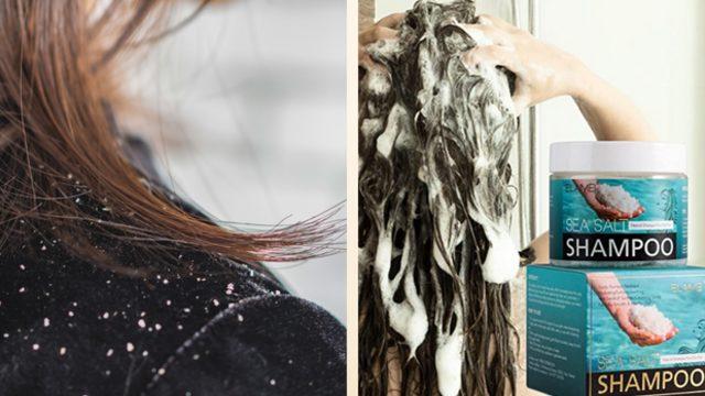 Kepek sorunu yaşayanların sorununu kökten çözmeye yardımcı ürün önerileri