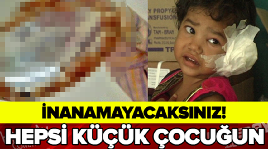 K&uuml;&ccedil;&uuml;k &Ccedil;ocuğun Kulağından &Ccedil;ıkanlar T&uuml;m D&uuml;nyayı Şoke Etti!