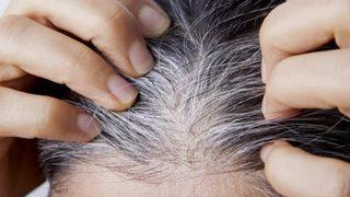 Ağzınıza bile sürmeyin! Saçları beyazlatan besinler belirlendi