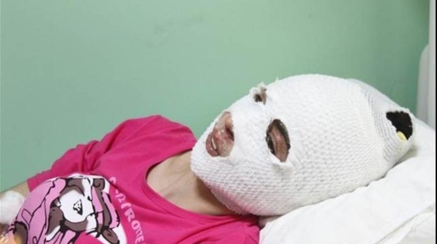 Düdüklü tencere patladı, bu hale getirdi