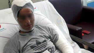 Kadına şiddetin son örneği: Ayak kırma, tırnak çekme