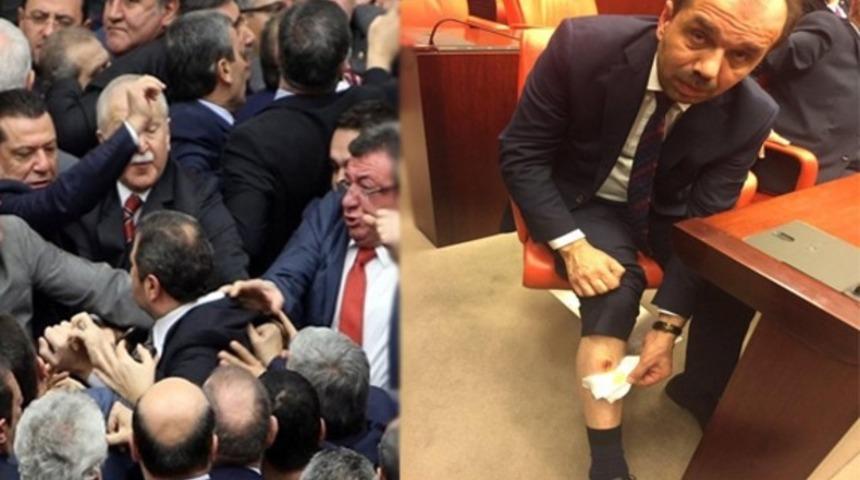 Adli Tıp ’AK Parti Trabzon Milletvekili ısırıldı’ dedi