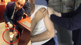 Adli Tıp 'AK Parti Trabzon Milletvekili ısırıldı' dedi