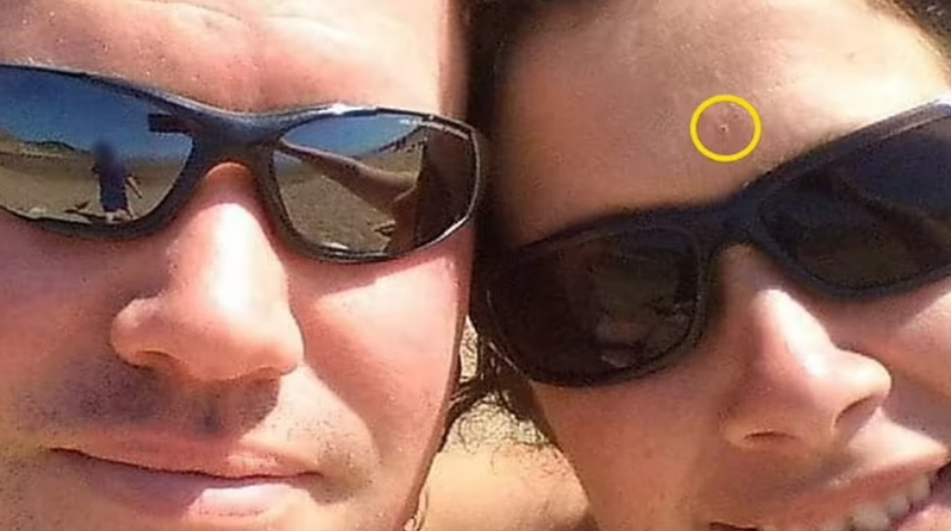 Her şey küçük bir çizgiyle başladı! Alnında çıkan iz nedeniyle kanser olduğunu öğrendi