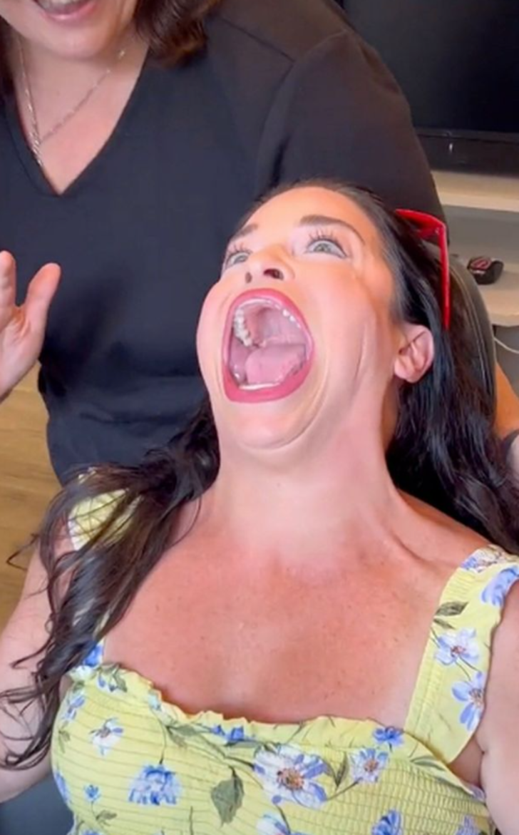 Dünyanın en büyük ağzına sahip kadını dişçi muayenesine gitti! Kırmızı halı serilince sosyal medyada gündem oldu G4