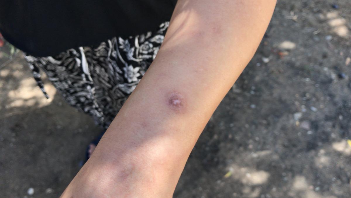 Adana'da, kadını ve bebeğini darbeden zanlının evi ateşe verdiği &ouml;ne s&uuml;r&uuml;ld&uuml;