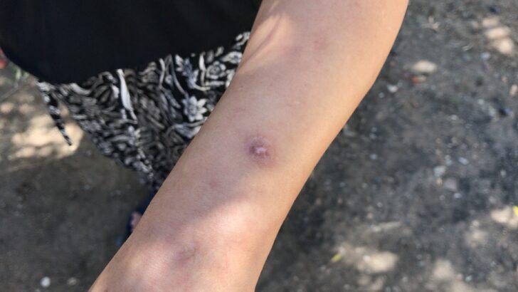 Adana'da, kadını ve bebeğini darbeden zanlının evi ateşe verdiği öne sürüldü G1