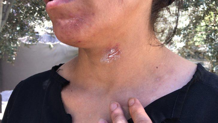 Adana'da, kadını ve bebeğini darbeden zanlının evi ateşe verdiği öne sürüldü G4