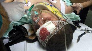 Samsun’da maganda kurşunu kameramana isabet etti