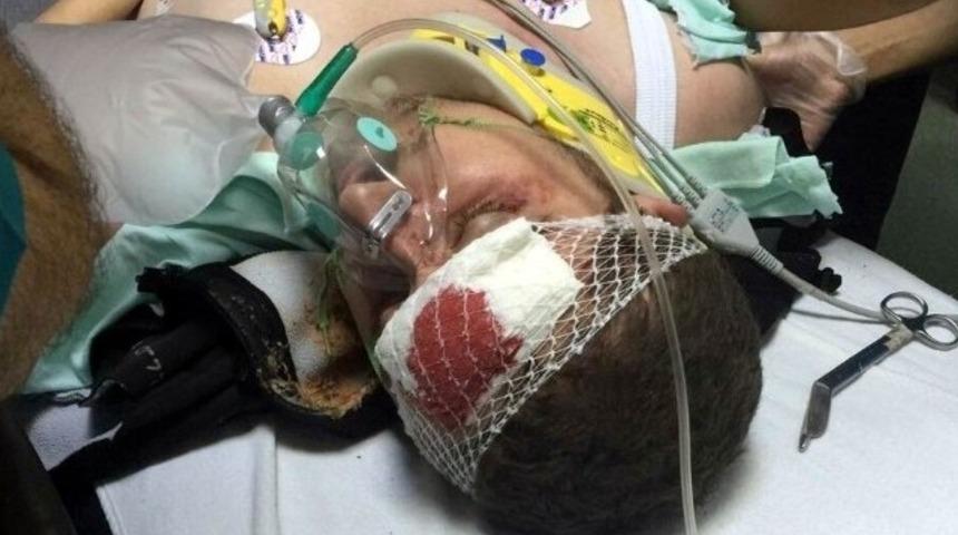 Samsun’da maganda kurşunu kameramana isabet etti