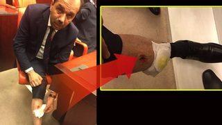   Meclis’teki ‘ısırık’ iddiasına soruşturma