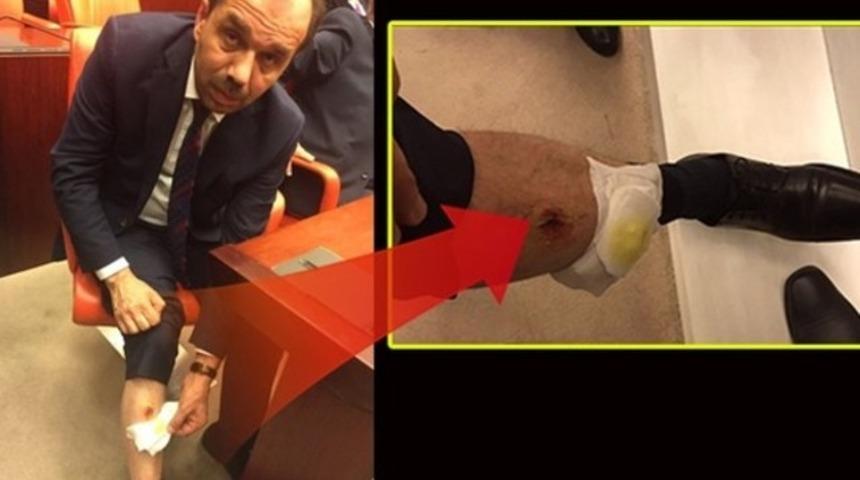   Meclis’teki ‘ısırık’ iddiasına soruşturma