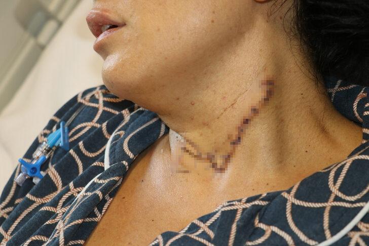 Adana'da eski erkek arkadaşının bıçakladığı kadının tedavisi sürüyor G2